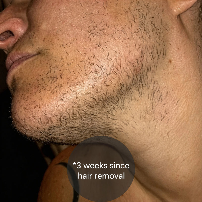 Before and after — day 1 of treatment