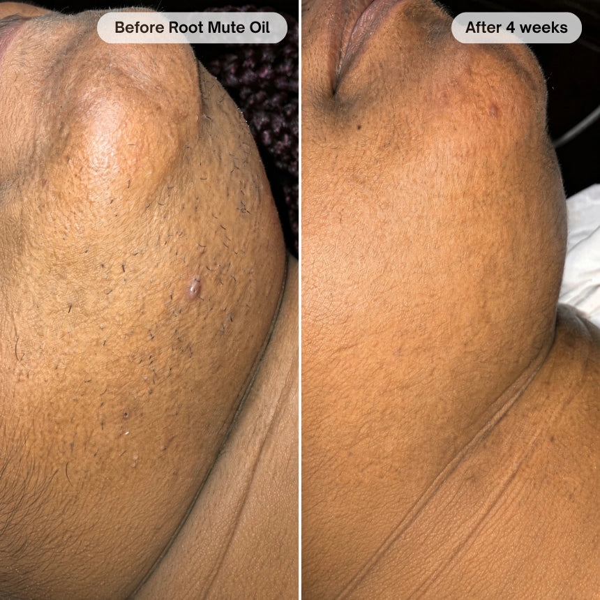 Before and after customer transformation 6
