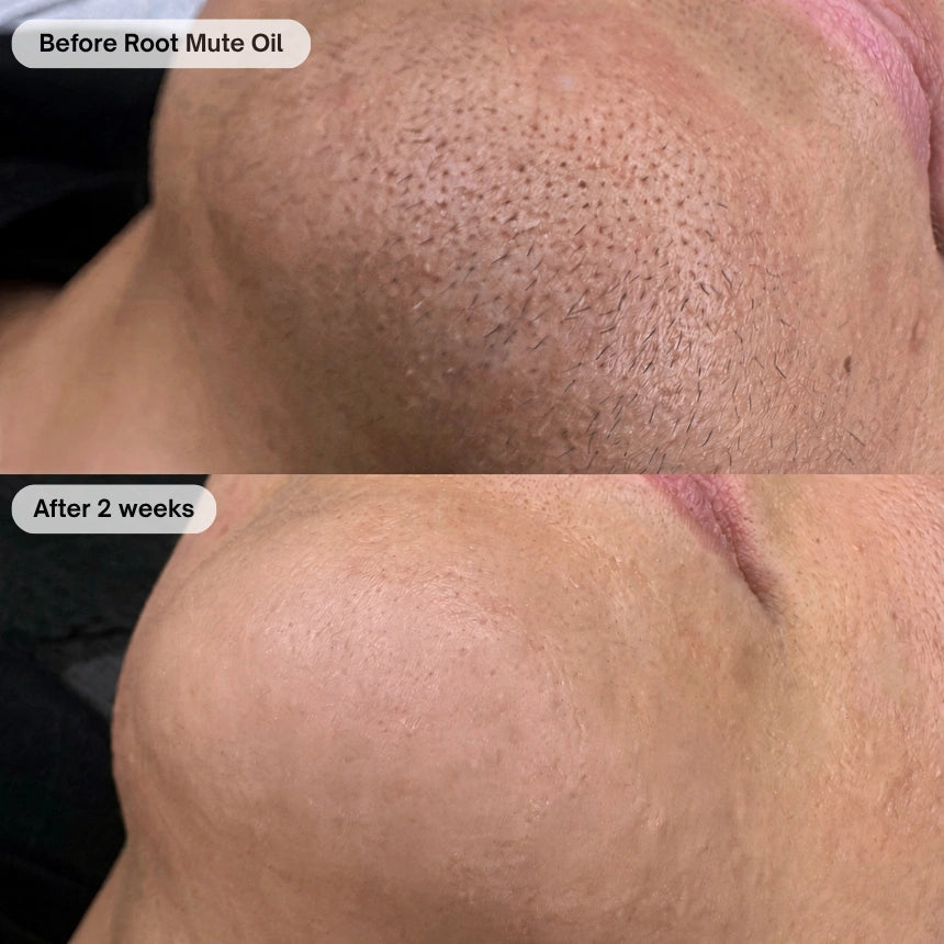 Before and after customer transformation 7