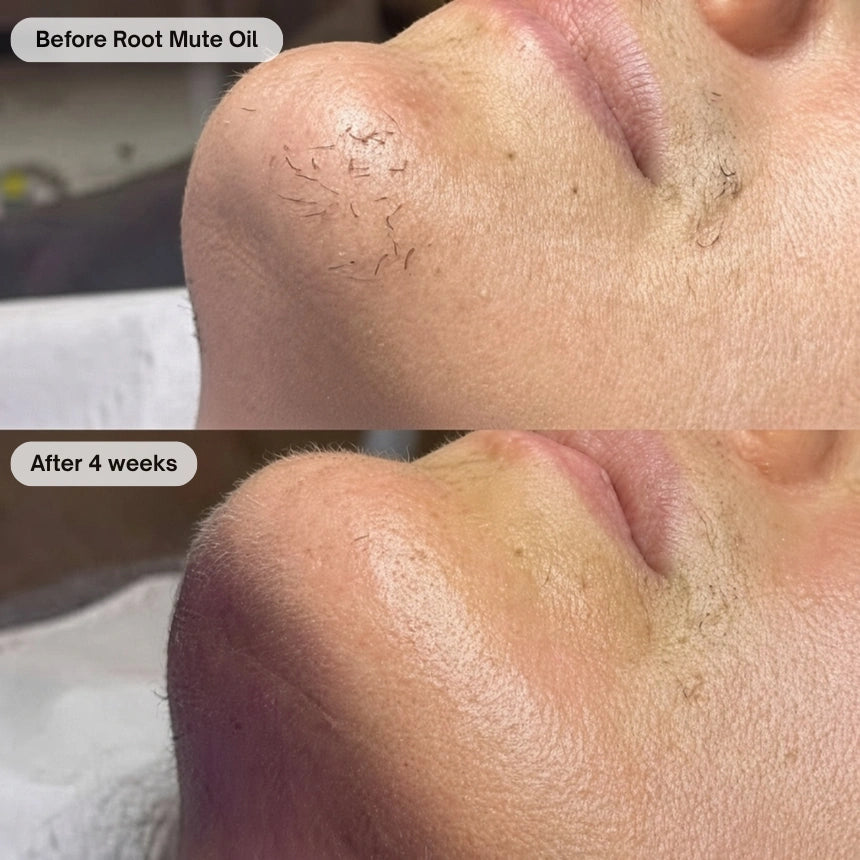 Before and after customer transformation 9