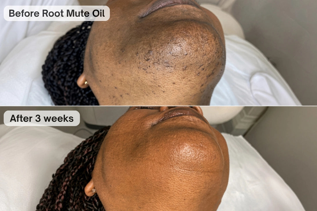 Customer transformation 4