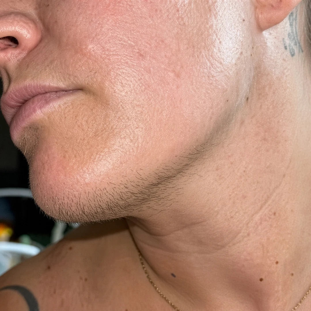 Before and after — week 6 of treatment